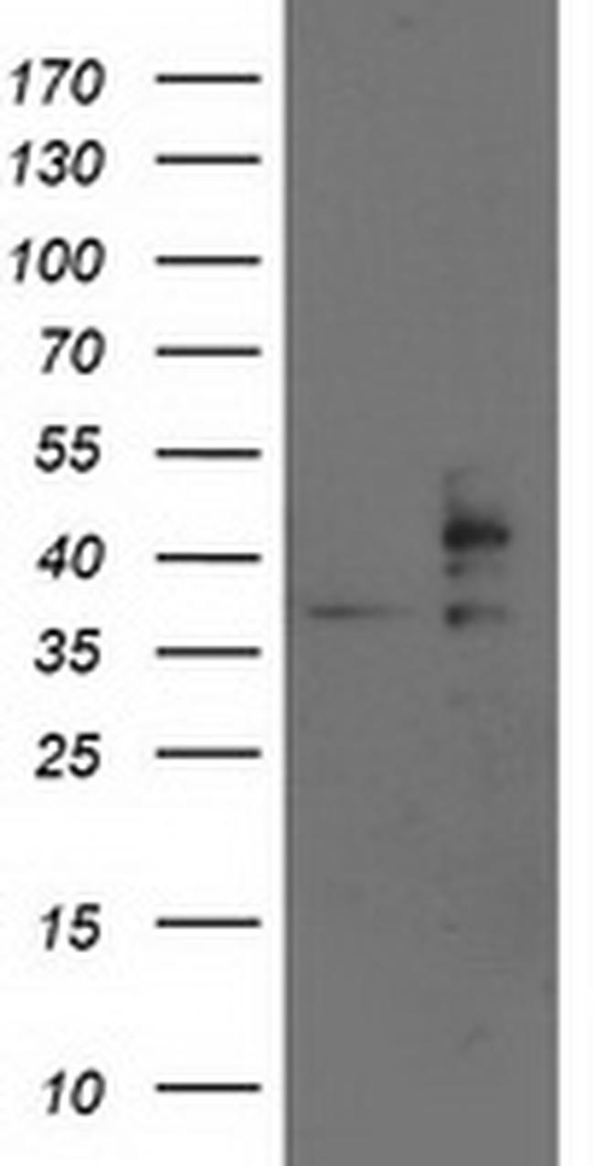 SSR1 Antibody in Western Blot (WB)