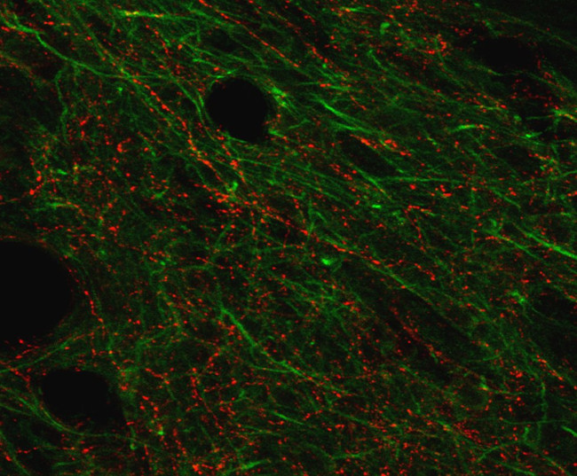 SSTR4 Antibody in Immunohistochemistry (IHC)