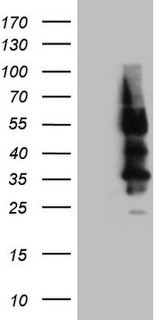 SSTR4 Antibody in Western Blot (WB)