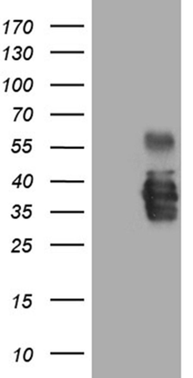 SSU72 Antibody in Western Blot (WB)