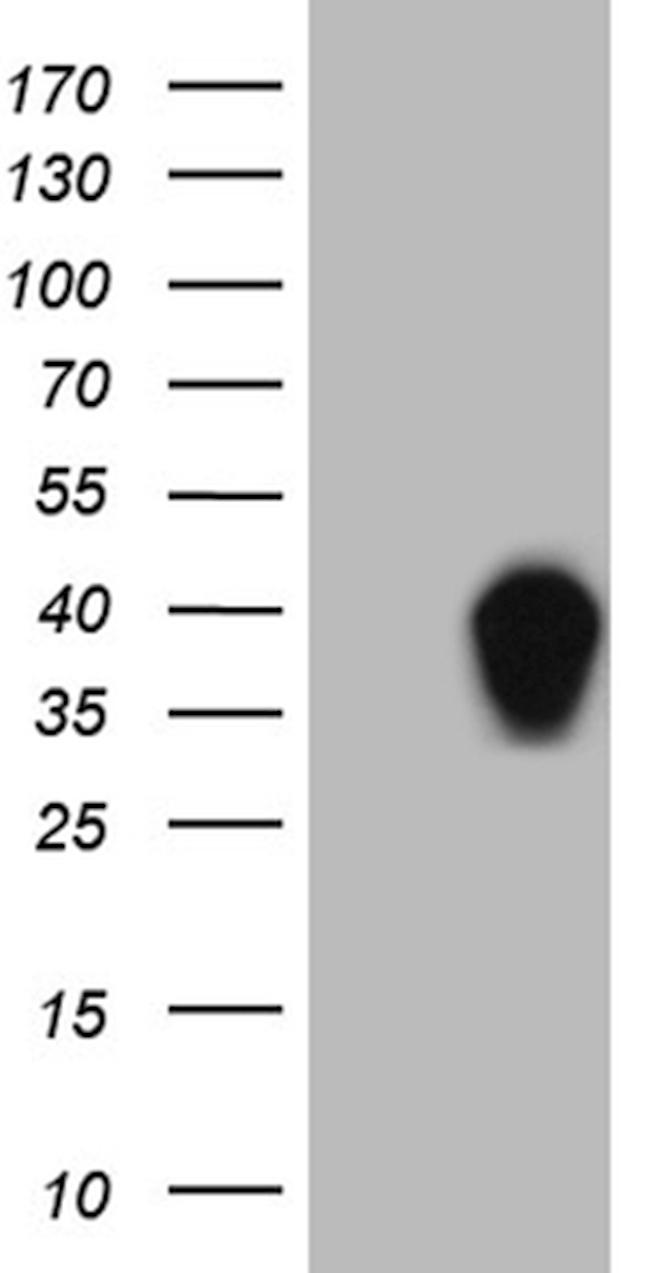 SSU72 Antibody in Western Blot (WB)
