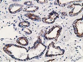 SSX1 Antibody in Immunohistochemistry (Paraffin) (IHC (P))