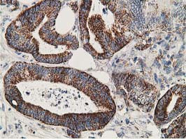 SSX1 Antibody in Immunohistochemistry (Paraffin) (IHC (P))