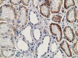 SSX1 Antibody in Immunohistochemistry (Paraffin) (IHC (P))