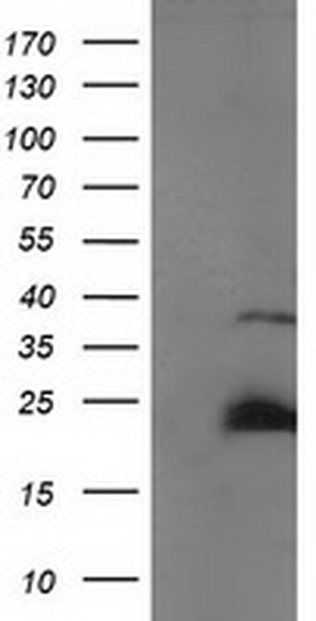 SSX1 Antibody in Western Blot (WB)