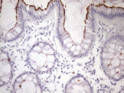 SSX2IP Antibody in Immunohistochemistry (Paraffin) (IHC (P))