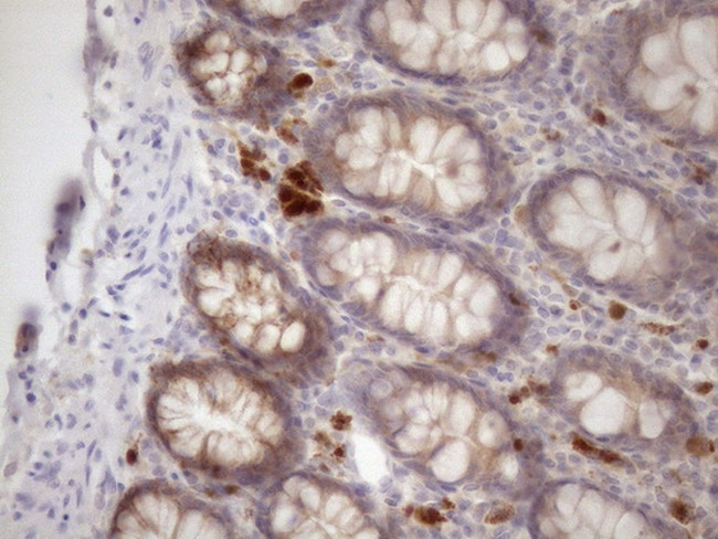 SSX2IP Antibody in Immunohistochemistry (Paraffin) (IHC (P))