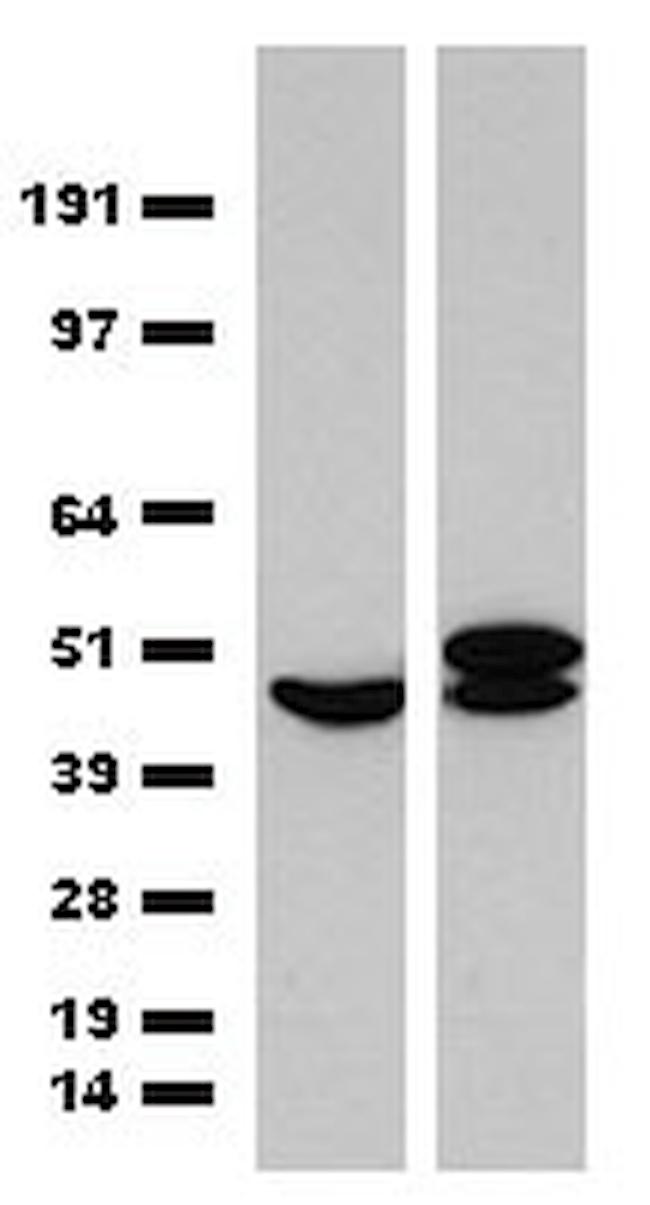 ST13 Antibody in Western Blot (WB)