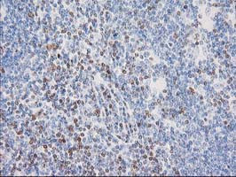 STAT4 Antibody in Immunohistochemistry (Paraffin) (IHC (P))