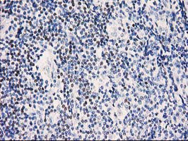 STAT5A Antibody in Immunohistochemistry (Paraffin) (IHC (P))