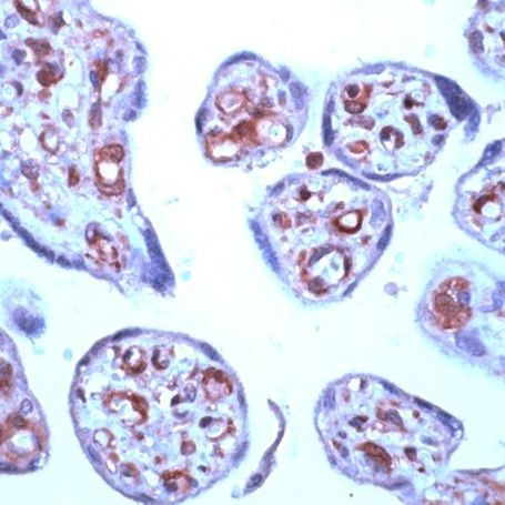 STAT6 Antibody in Immunohistochemistry (Paraffin) (IHC (P))