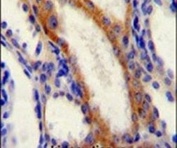 STIM1 Antibody in Immunohistochemistry (IHC)