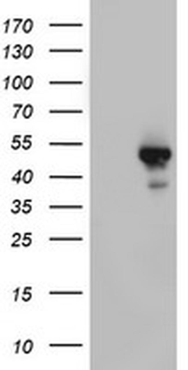 STK11 Antibody in Western Blot (WB)