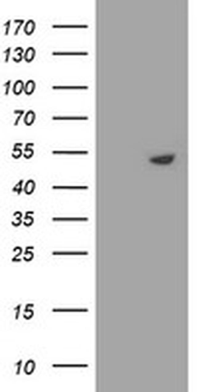STK11 Antibody in Western Blot (WB)