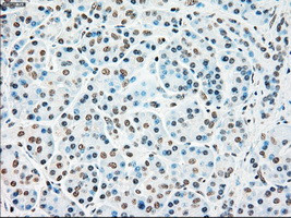 STK3 Antibody in Immunohistochemistry (Paraffin) (IHC (P))