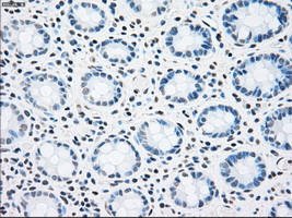 STK3 Antibody in Immunohistochemistry (Paraffin) (IHC (P))