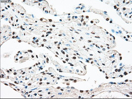 STK3 Antibody in Immunohistochemistry (Paraffin) (IHC (P))