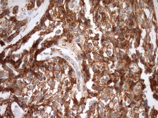 STOML2 Antibody in Immunohistochemistry (Paraffin) (IHC (P))