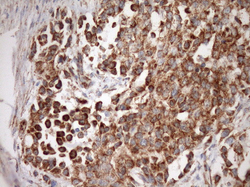 STOML2 Antibody in Immunohistochemistry (Paraffin) (IHC (P))