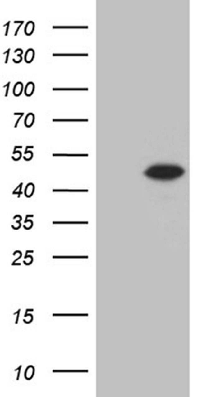 STX18 Antibody in Western Blot (WB)