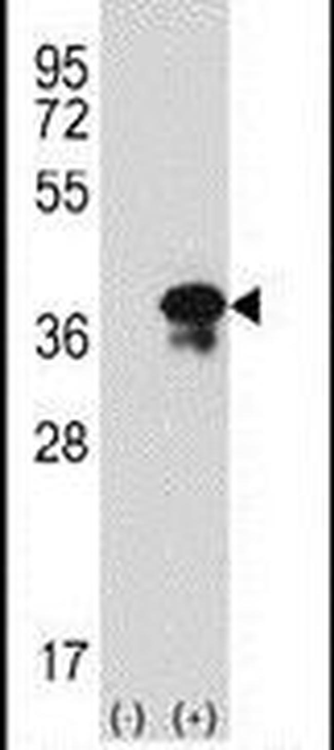 Syntaxin 3 Antibody in Western Blot (WB)