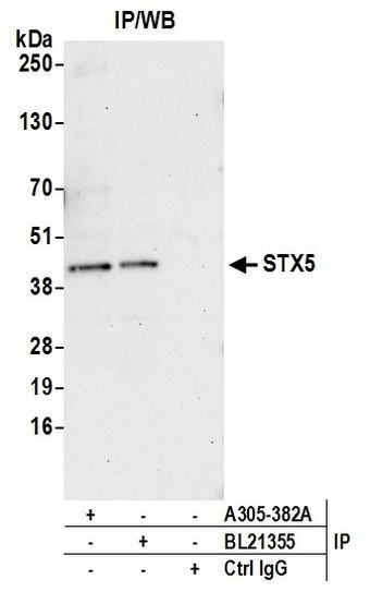 STX5 Antibody in Immunoprecipitation (IP)