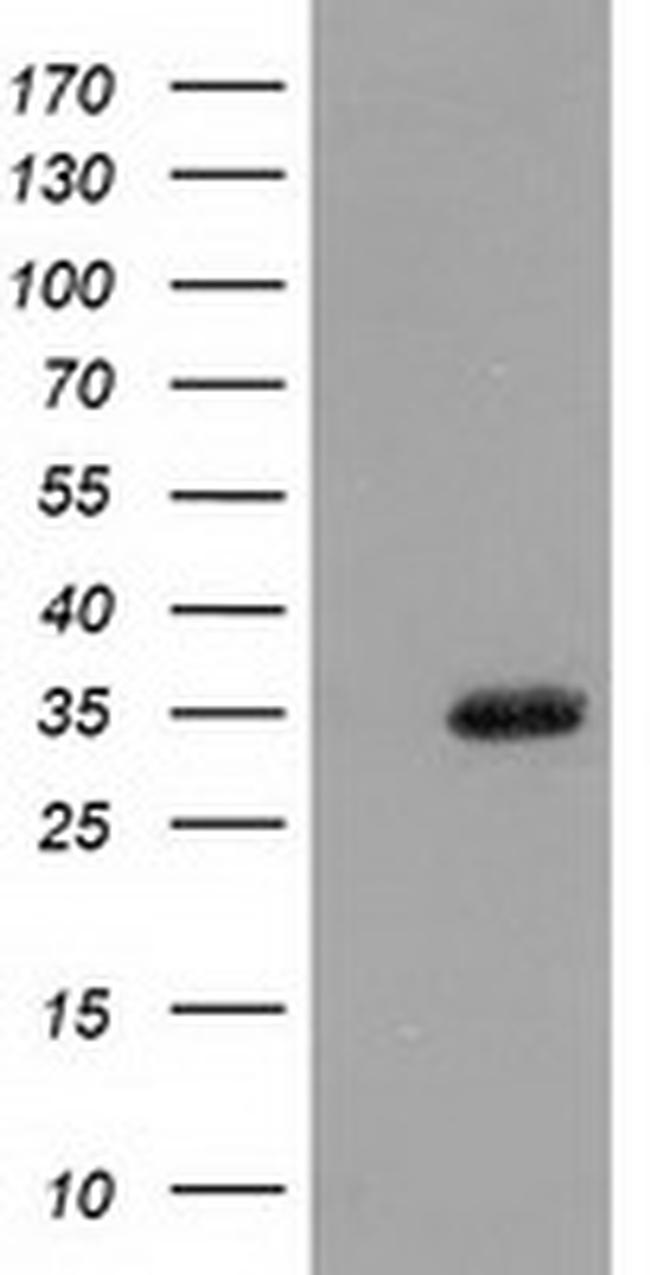 SULT1A1 Antibody in Western Blot (WB)