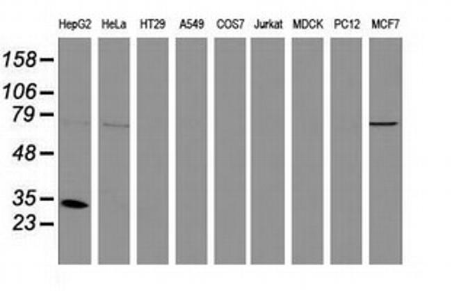 SULT1A1 Antibody in Western Blot (WB)