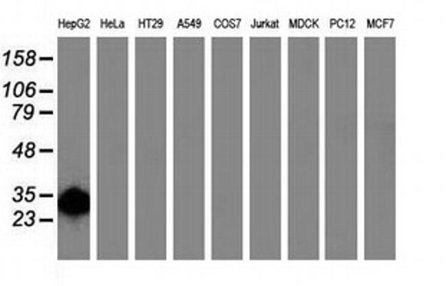 SULT1A1 Antibody in Western Blot (WB)