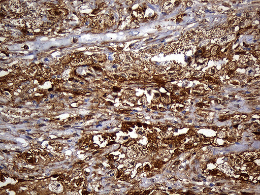 SULT1A3 Antibody in Immunohistochemistry (Paraffin) (IHC (P))