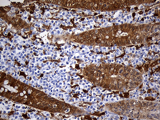 SULT1A3 Antibody in Immunohistochemistry (Paraffin) (IHC (P))