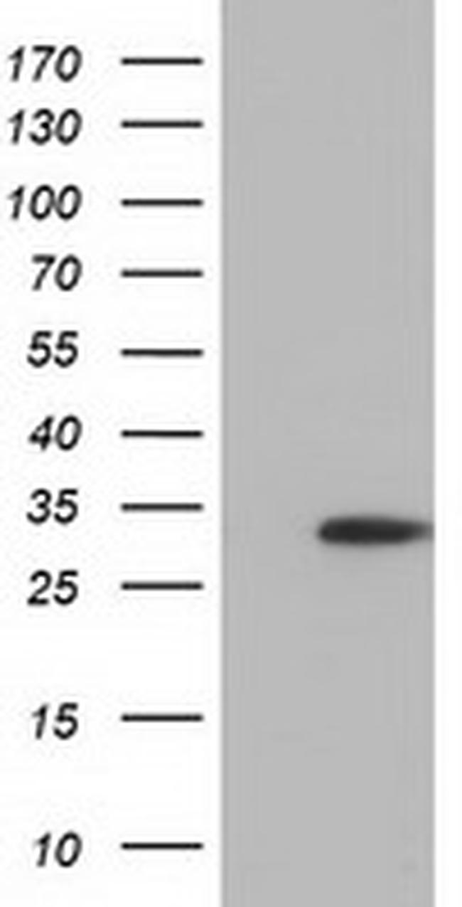 SULT2A1 Antibody in Western Blot (WB)