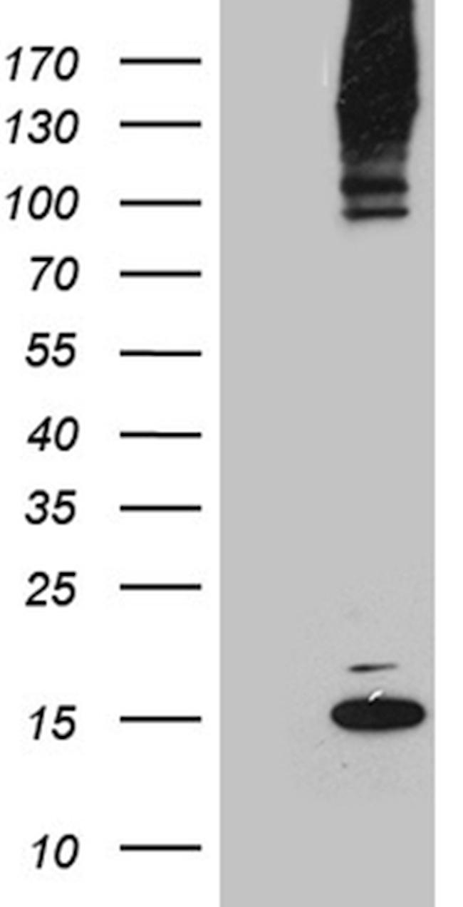 SUMO1 Antibody in Western Blot (WB)