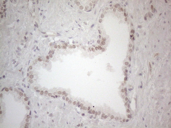 SUPT3H Antibody in Immunohistochemistry (Paraffin) (IHC (P))