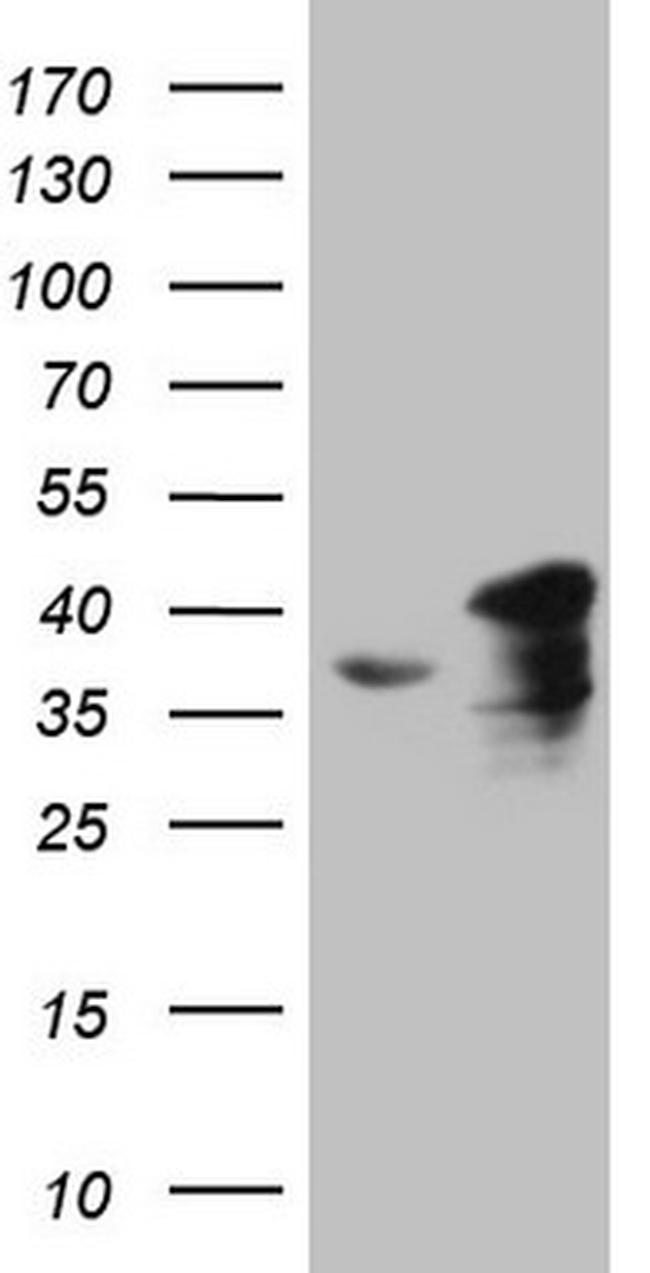 SUPT3H Antibody in Western Blot (WB)