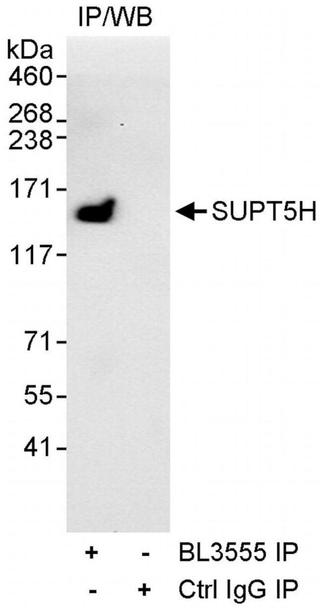 SUPT5H Antibody in Immunoprecipitation (IP)