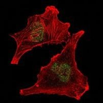 SUZ12 Antibody in Immunocytochemistry (ICC/IF)