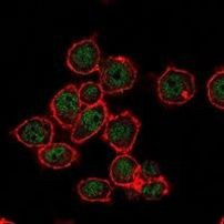 SUZ12 Antibody in Immunocytochemistry (ICC/IF)