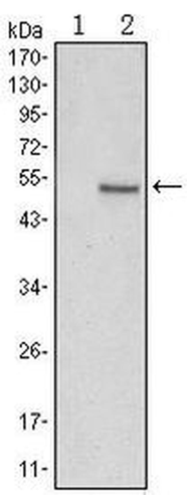 SUZ12 Antibody in Western Blot (WB)