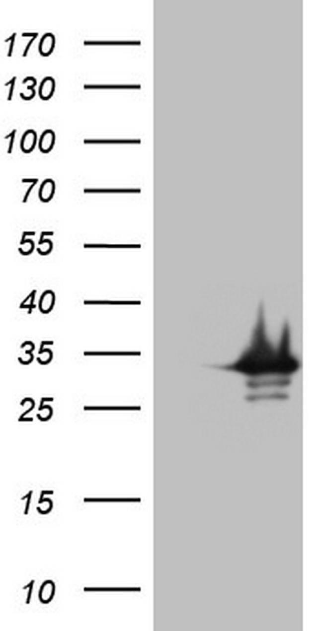 SYCP3 Antibody in Western Blot (WB)