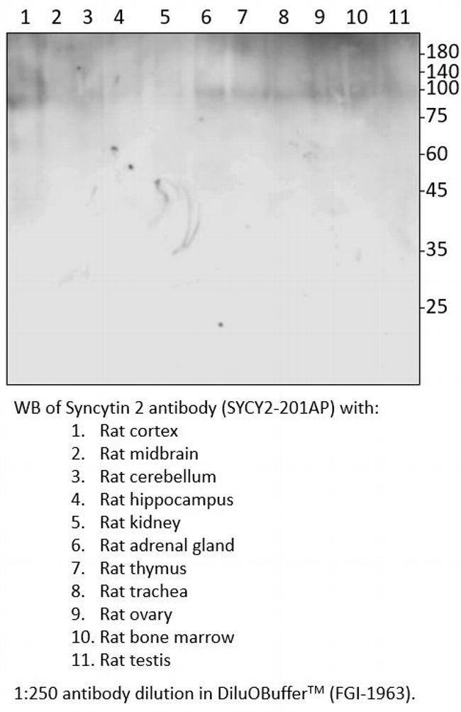 Syncytin 2 Antibody in Western Blot (WB)