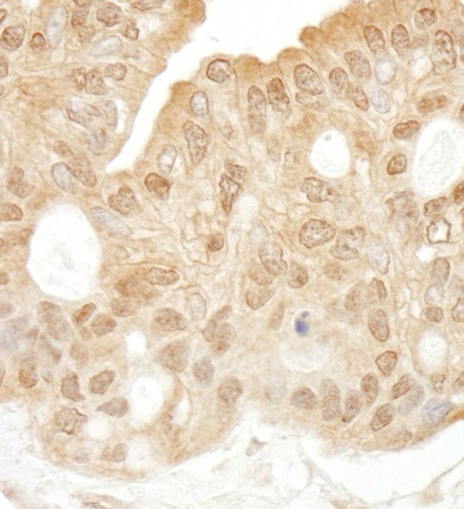 SYK Antibody in Immunohistochemistry (IHC)