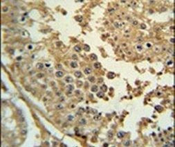 Synapsin 3 Antibody in Immunohistochemistry (IHC)