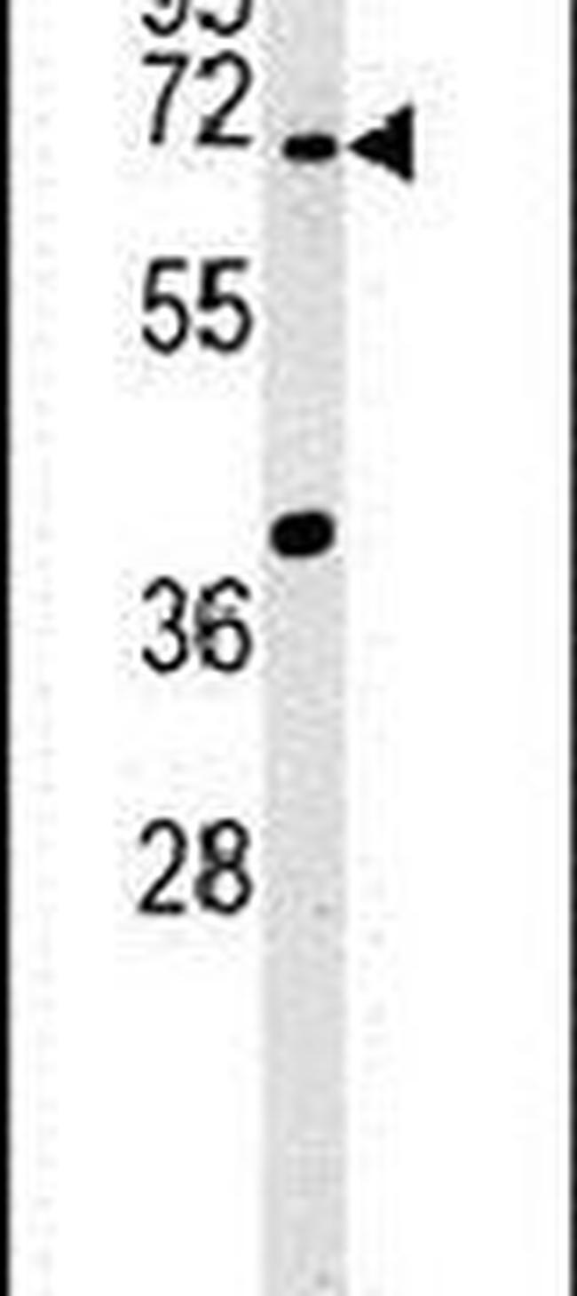 Synapsin 3 Antibody in Western Blot (WB)