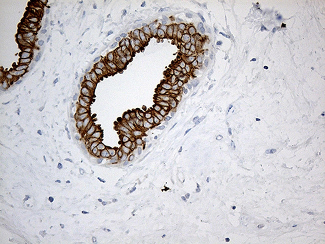 SYNE1 Antibody in Immunohistochemistry (Paraffin) (IHC (P))