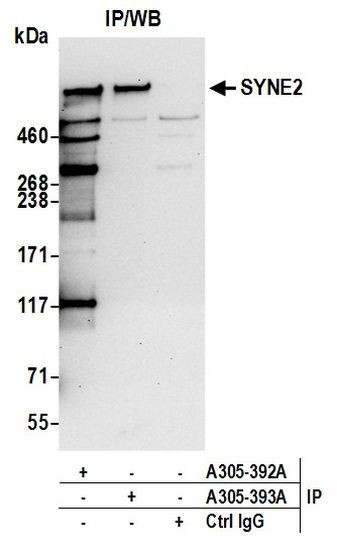 SYNE2/Nesprin 2 Antibody in Immunoprecipitation (IP)