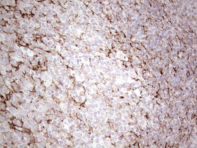 SYNM Antibody in Immunohistochemistry (Paraffin) (IHC (P))