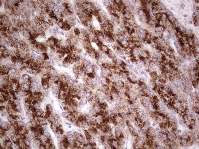 SYNM Antibody in Immunohistochemistry (Paraffin) (IHC (P))