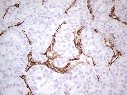 SYNM Antibody in Immunohistochemistry (Paraffin) (IHC (P))