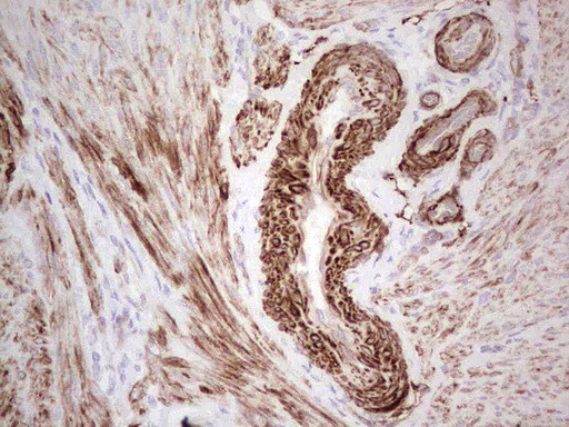 SYNM Antibody in Immunohistochemistry (Paraffin) (IHC (P))